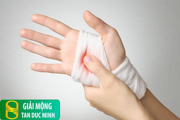 Nằm mơ thấy mình chảy máu tay